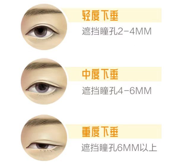 圖片.png 圖片.png