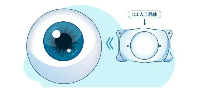 圖片.png 圖片.png